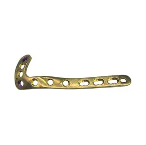 Variable Angle Proximal Lateral Tibial Locking Plate