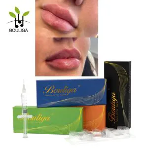 Long Lasting Hyaluronic Acid Filler Ha Gel for Face Beauty