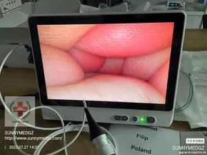 Sy-P029-3 Easy Oprtation Control 180 Degree Ent Portable Small Screen Customize The Scope Size Reusable Flexible Ureteroscope