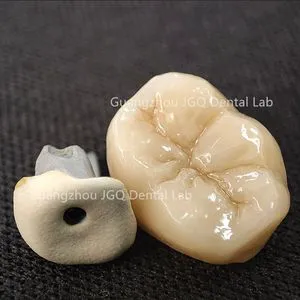 Protheses Dentaires Numeriques Milling Dental Zirconia Crown Perfect Fit Molar with Metal Post