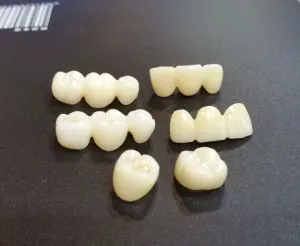 High Strength Denture Zirconia Ceramic Discs 1500MPa