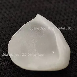 Dental Items IPS Emax Porcelain Veneers Cheap Price for Tooth Whitening