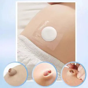 Waterproof Transparent PU Infant Belly Care Patch Disposable Umbilical Hernia Repair Kit