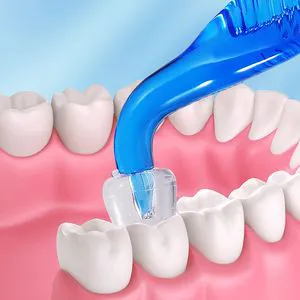 Dental Composite Curing Posterior Teeth Aesthetic Printing Mould Kit Price to Reshape Teeth