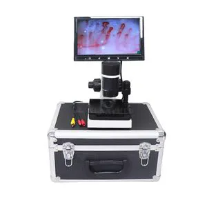 Sy-B198 Digital Capillary Microscope Capillaroscope Connected to Laptop with LCD Screen
