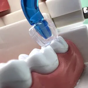 Dental Posterior Teeth Aesthetic Printing Mould Kits