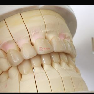 Dental Full Contour Zirconia Crowns and Bridges Custome Shade Matching Dental Lab China