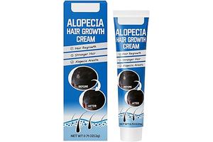 Alopecia Hair Growth Cream – Herbal Scalp Care for Solid Hair Roots, Promoting Regrowth and Fuller Hair。