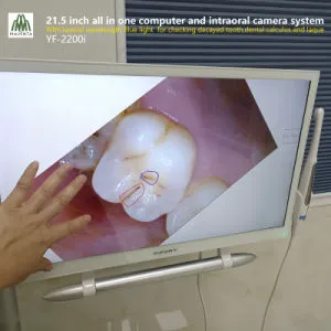 Windows 10 All in One PC (with Independent graphics card) and USB Dental Intraoral Camera System for Dental Unit