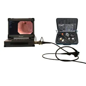 Geiwre Medical HD Endocope System with Gastroscope&Colonoscope Video Enodoscope