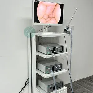 Hot-Selling Gastroscope, Colonoscope, Gastrointestinal Endoscope for Hospital Use