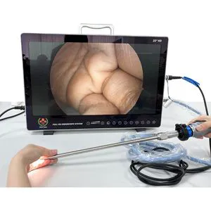 Sy-PS050 Portable Full HD Endoscope Camera Hysteroscopy