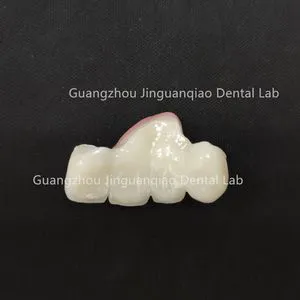 Perfect Looking Beautiful Zirconia Ceramic Crowns with Gum Lifelike China Dental Lab