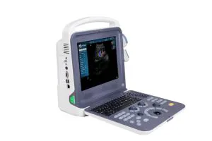Easy -Carried Ultrasound Scanner K0