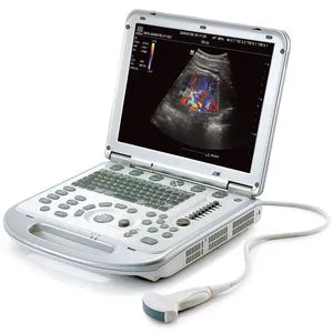 Popular Mindray Dp20 Portable Digital Bw Ultrasound USG Pw iTouch Izoom