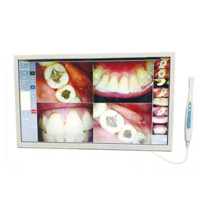 Sjd-I960 USB Camera Handle 12 Million Pixels Dental 21.5 Inches Touch Screen Computer Type Intra Oral Camera