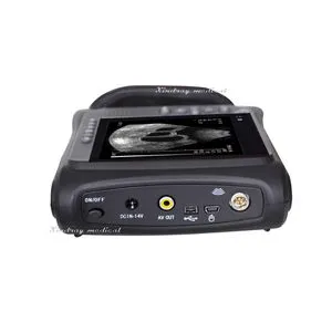 Top Quality Portable Hospital Equipment Color Doppler Ultrasound Diagnostic System with Best Price