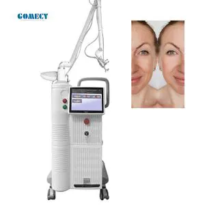 China Medical CE Approved Scar Removal Vaginal Tightening 10600nm Laser CO2 Fractional Laser Skin Resurfacing Machine