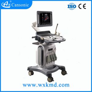 4D Color Doppler Ultrasound Scanner with Excellent Image