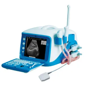 Wt-6000 Full Digital Portable Color Doppler Ultrasound Scanner