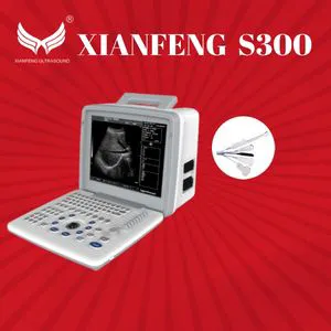 Hot Sale Economic Portable Ultrasound Scanner / Clinic Hospital Medical Device