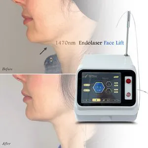 Skin Tightening Facial Lifting 1470nm Endolaser Liposuction Fiber Laser Lipolysis Shaping Machine