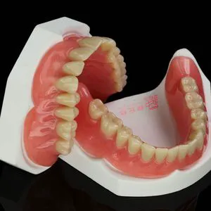 Customized Removeable Complete Adsorptive Dentures Made in China Dental Lab for Dental Restoration