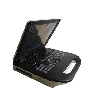 High-Frequency Portable Ultrasound Scanner Medical Equipment Laptop Portable Ultrasound