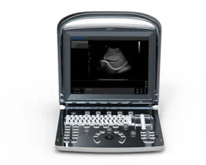 Chison Eco 1 B&W Ultrasound Portable Ultrasound Scanner Chison Eco1 Ultrasound Machine