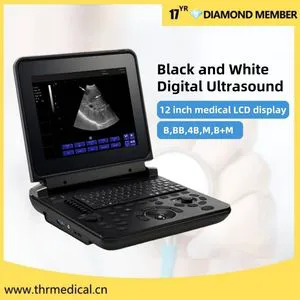 Digital Diagnostic Ultrasound System Portable Black and White Ultrasound Machine