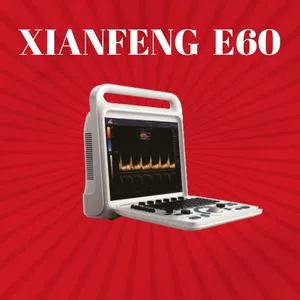 2D/3D/4D Laptop Color Doppler Ultrasound Scanner 15 Inches