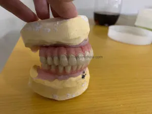 Monolithic Zirconia Implant Bridge Made in China Dental Lab Dental Implants