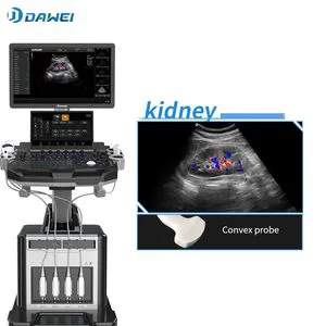 2D 3D 4D Ecografia Doppler Color Proveedores PARA Obstetricia Echo Machine