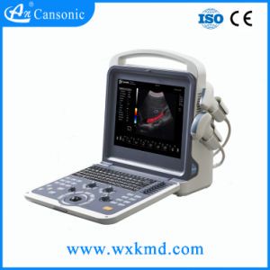 Echo Cardiac Color Doppler Ultrasound Scanner