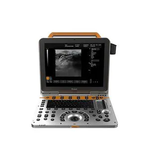 Dawei Medium-High Level Portable Color Doppler Ultrasound Scanner for Msk Dw-P6