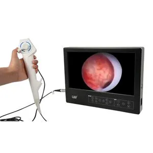 Medical Equipment Flexible Integrated HD Electronic Ureteroscope with 13.3”