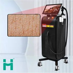 2025 Switchable Spot Titanium Laser Hair Removal Diode Laser Handpiece Titanium 1200 W Fast Hair Removal