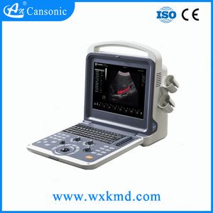 Portable 4D Color Doppler Ultrasound Scanner Similar with Sonoscape S2