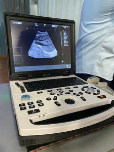 Dw-690 Dual Transducer Primary Care 2D Abdominal Urology Ultrasound Scanner