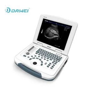 Latest Dw-580 Laptop Black and White Ultrasound Portable Machine with Cheaper Price