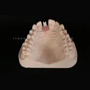 Dental Implant Custom Zirconia Abutment with Aesthetic Alternative to Metal Implant Abutments