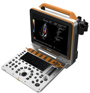Dawei Hot-Sale Portable Color Doppler Ultrasound Dw-P60 for Wohle Body Checking