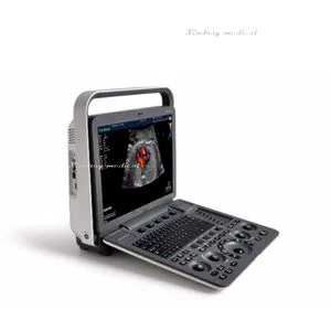 Top Quality Lager Screen Full Digital Portable Ultrasound 4D Color Doppler