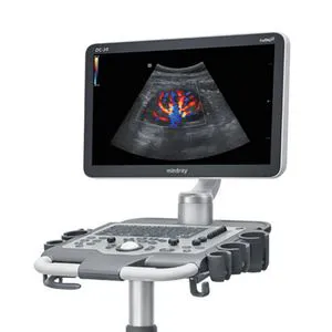 Trolley Color Doppler Ultrasound Guidance System DC-26