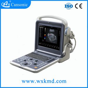 Portable Full Digital Ultrasound Scanner with Low Price (K2)