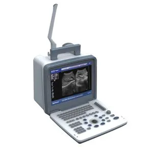 Medical Diagnostic Ultrasound Doppler Echo Ultrasound Scanner Portable Ultrasound Machine
