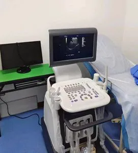 Color Doppler Ultrasound Machine with HD Imaging and Trolley Stand