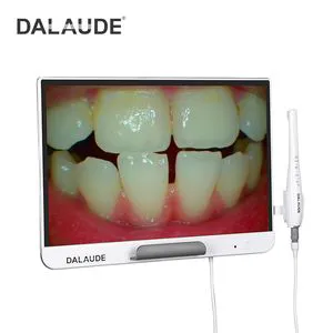 15megapixel Intraoral Camera Provides The Dentist with HD Solution Pictures