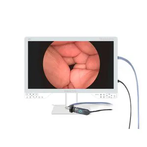 4K Ultra HD Integrated Endoscopy Camera Medical 4K UHD Endoscope Camera System for Laparoscopic Surgery
