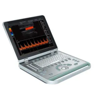 Echographie Medical Doppler Echography Machine Ultrasound Manufacturers Mobile Ultrasound Scanner for Breast
